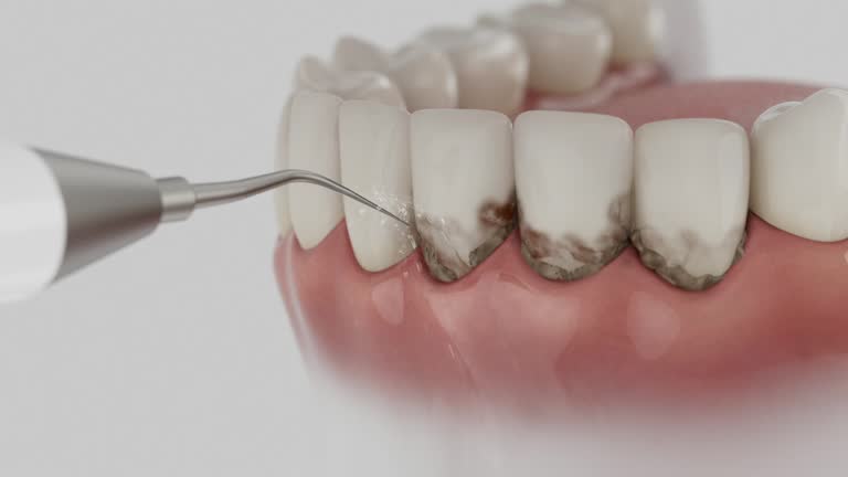 Reliable Root Canal Treatment contractor in Lafayette County County, AR by Dentist Open Now